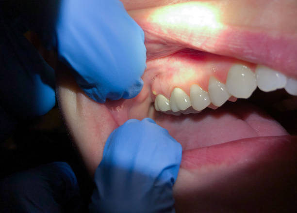 Best After-Hours Emergency Dentist in Rockwell Place, TX
